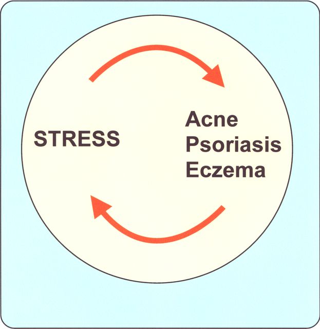 Stress and Atopic Eczema Atopic Skin Disease